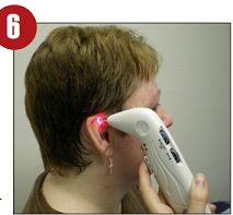 Aurikuloterapia laserowa