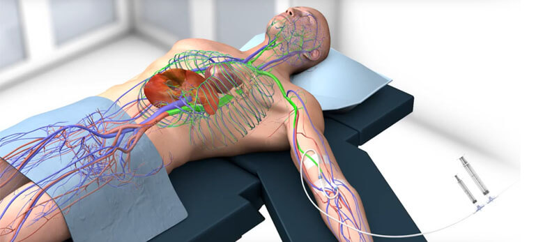 Obrazowanie fluorescencyjne ICG - aplikacja