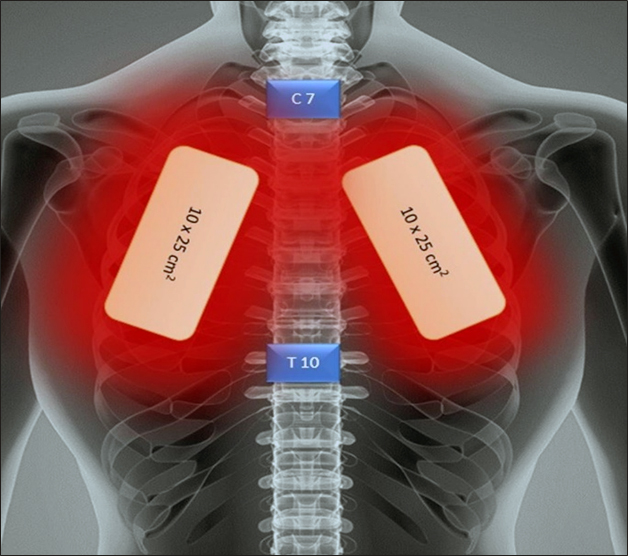 Leczenie PBMT u pacjenta z COVID-19