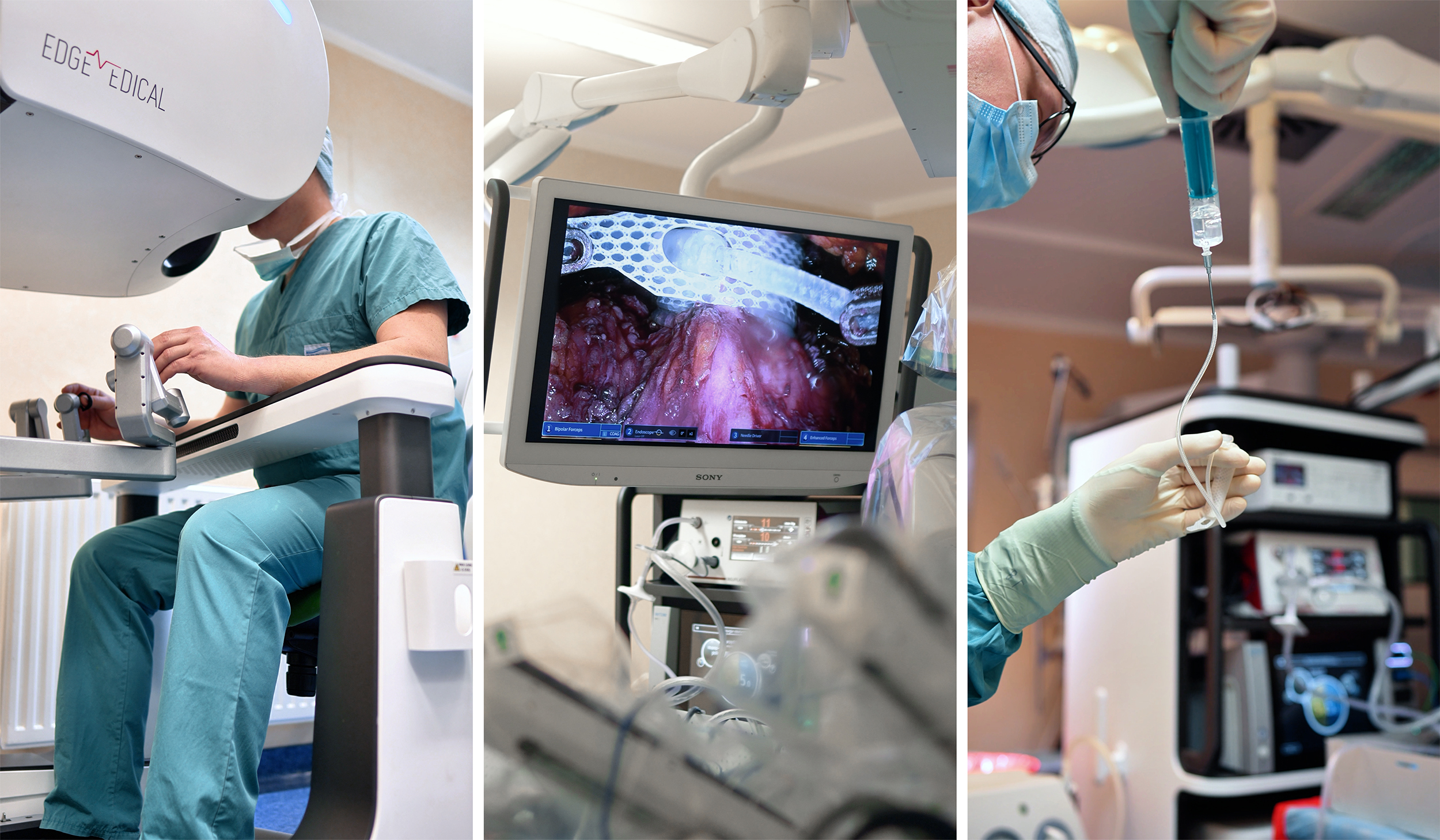 Robotyczne wszczepienie sztucznego zwieracza cewki moczowej